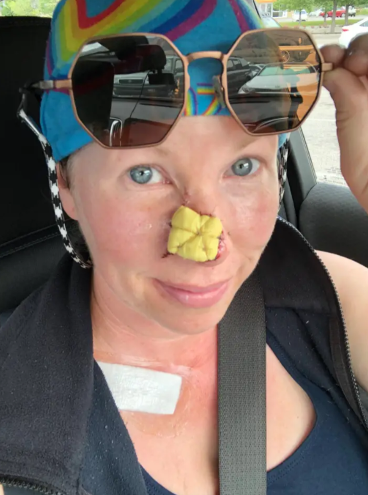 Her şey küçük bir sivilceyle başladı! “Burnumun ucunda çıktı, hayatımı kabusa çevirdi”