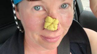 Her şey küçük bir sivilceyle başladı! “Burnumun ucunda çıktı, hayatımı kabusa çevirdi”