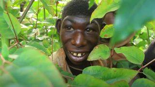 Dış görünüşü nedeniyle yıllarca ormanda tek başına yaşadı! Son hali herkesi şaşırttı