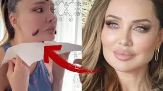 Yerli Angelina Jolie Umut Akyürek güzelleşmek için bunu da yaptı! Görenler şok oldu