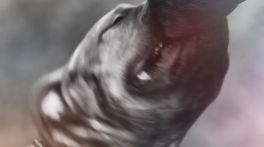 İstanbul'da pitbull saldırısı! 11 yaşındaki çocuk yaralandı...