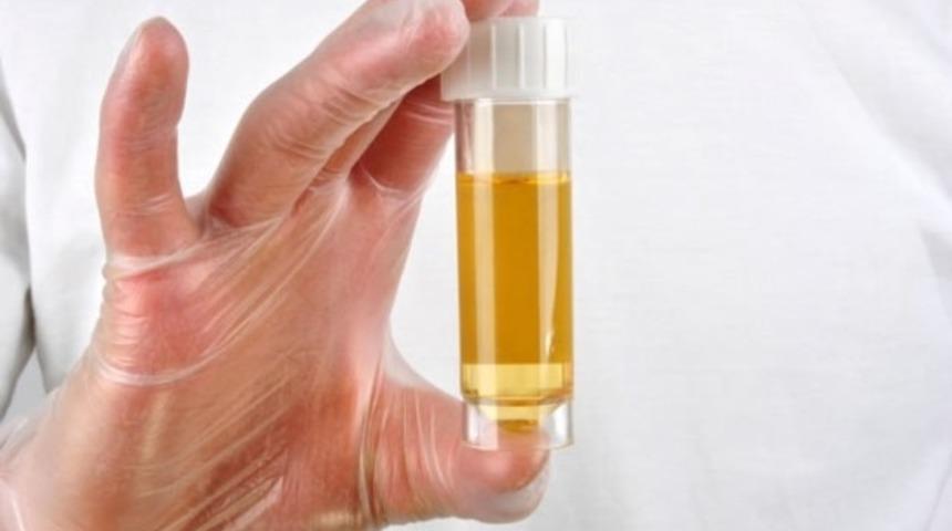 İdrardan kan gelmesi kanser belirtisi olabilir