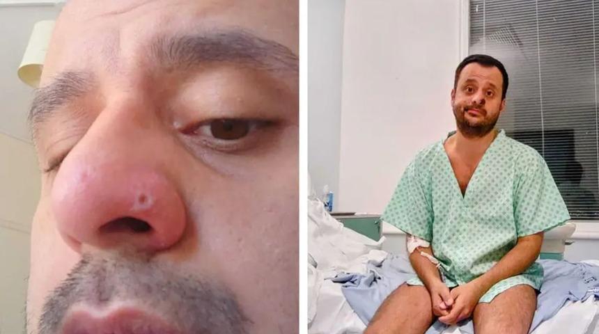 Maymun çiçeğine yakalanan Türk, Birleşmiş Milletler’in sitesinde yayınlandı: Sanırım öleceğim