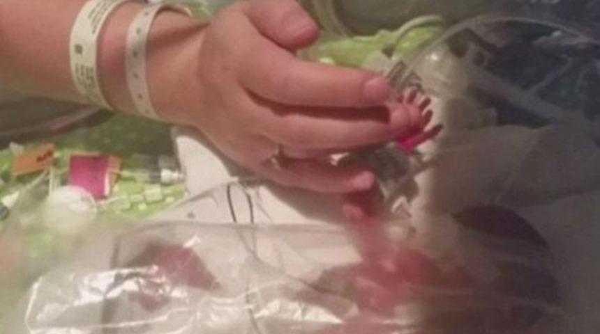 İkizlerden biri doğdu biri anne karnında