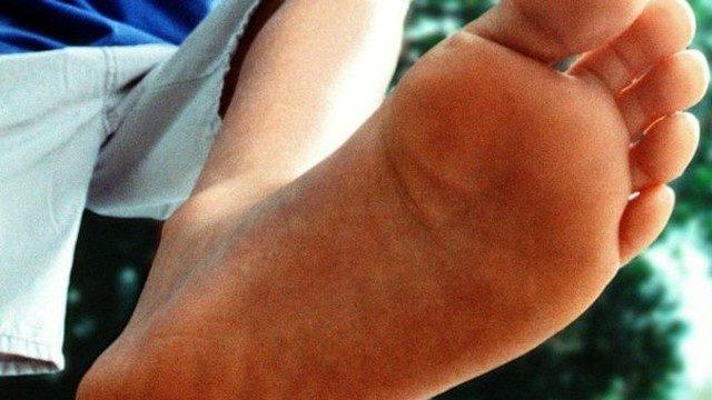 Ayak kokusunun sırları