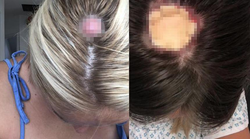 Kafasında delikle yaşıyor! Ne olduğu anlaşıldığında ise...