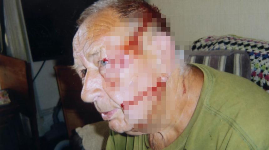 Evinin önündeki kuş yuvasına hamle yaptı! Martının saldırısına uğrayan adam kanlar içinde kaldı