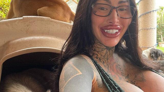 Dünyanın en büyük vajinasına sahip olmak için bıçak altına yatan fenomen bikinili pozuyla şaşkınlık yarattı