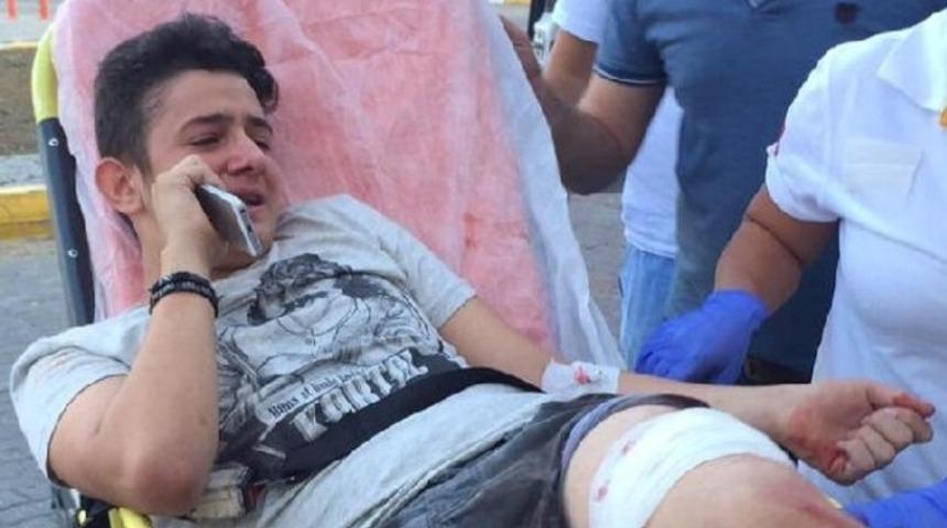 Gitar kavgası kanlı bitti: 1 yaralı