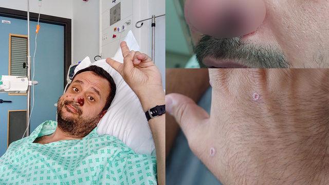 Dünyanın konuştuğu Türk! Önce HIV ve Kovid'i, sonra da maymun çiçeğini yendi: Ne HIV, ne maymun çiçeği, bu çok daha kötü etkiliyor