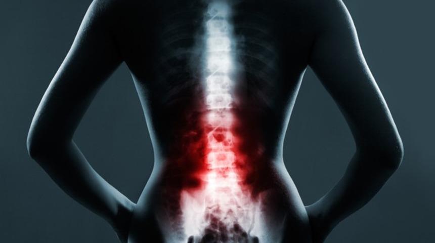 Omurga bozuklukları tatilinizi kabusa &ccedil;evirmesin