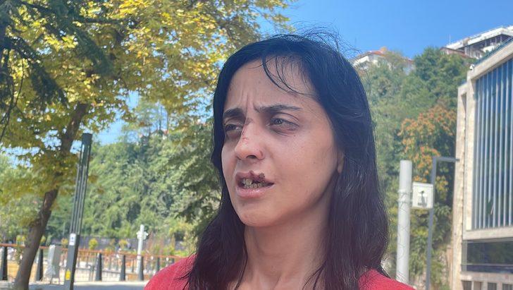 Zonguldak'ta tanımadığı genç kadını darbederek yaraladığı öne sürülen zanlı tutuklandı G3