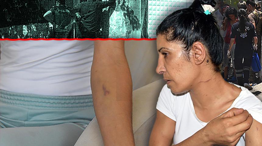 Bıçakla rehin alınan kadından şok sözler! 'Koçbaşı'lı operasyondan korkunç detaylar ortaya çıktı... 'Her baygınlık geçirdiğimde...'