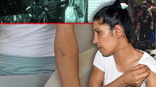 Bıçakla rehin alınan kadından şok sözler! 'Koçbaşı'lı operasyondan korkunç detaylar ortaya çıktı... 'Her baygınlık geçirdiğimde...'