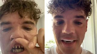 Sosyal medyada paylaşımı gündem oldu! Türkiye’ye gelip dişlerini yaptırdı, benzetmesi herkesi güldürdü