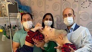 Operasyon tam 27 saat sürdü! Beyinleri kaynaşan yapışık ikizler...