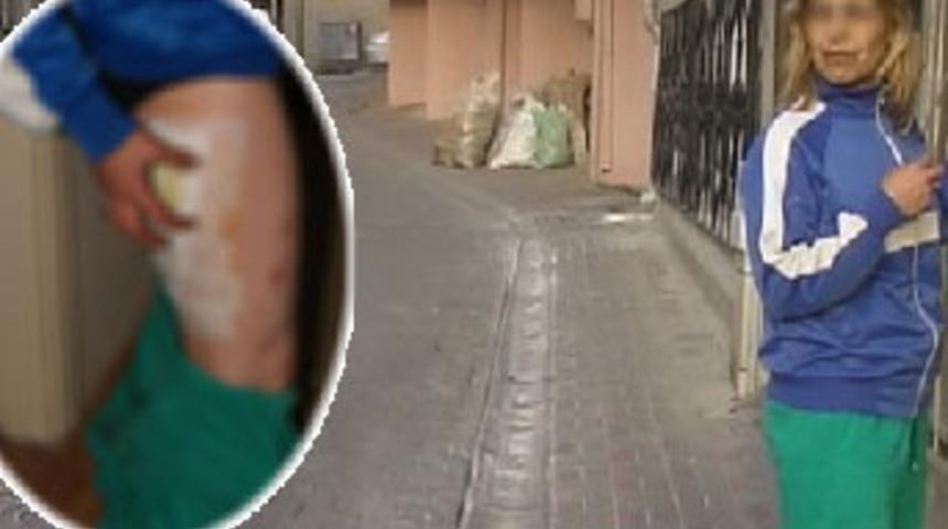 Sokak ortasında kezzaplı saldırı