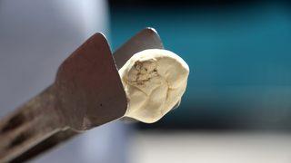 Fiyatı altınla yarışıyor! 'Daha da yükselecek'