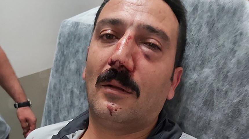 Sancaktepe'de hastane saldırısı! Hasta yakınları dehşet saçtı: Kafa atıp burnunu kırdılar