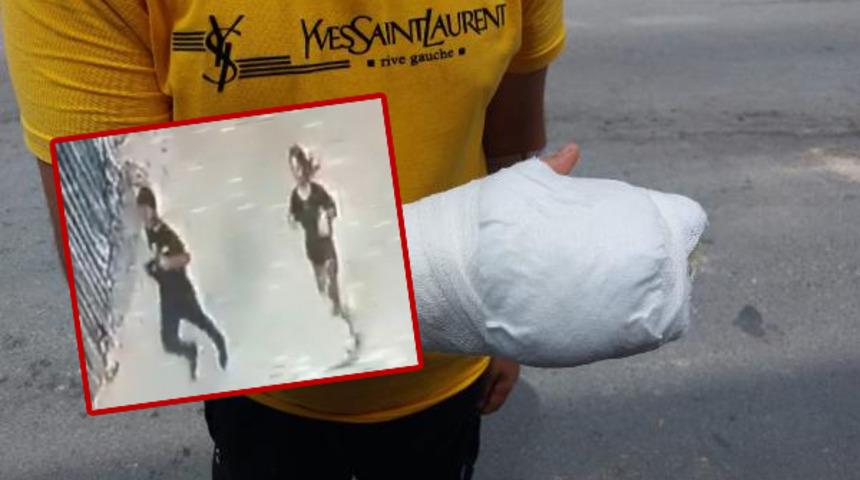 Çocukların TikTok macerası kanlı bitti! Şişeyi kırıp camla kesti