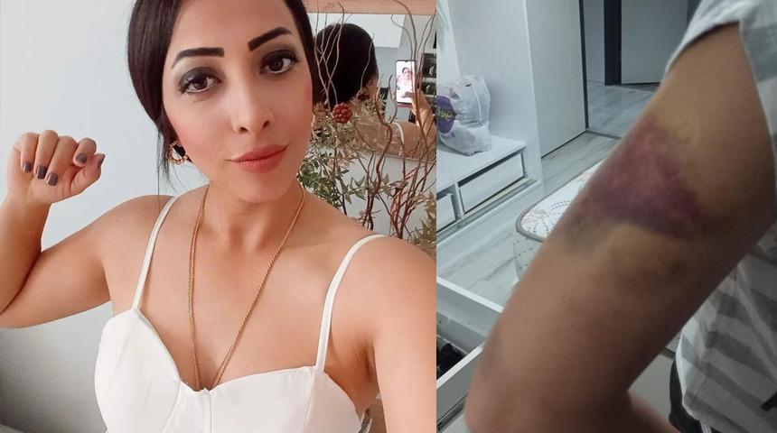 Adanalı Saime'nin yaşamadığı acı kalmadı! Önce başka aileye satıldı, sonra...