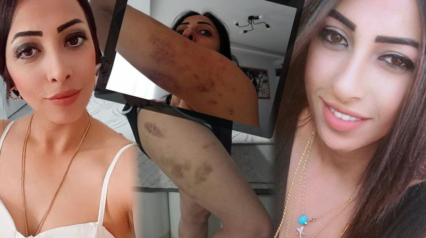 Öz annesi tarafından para karşılığında satıldı! Kabusu yaşıyor: 'Aşkım' demedim diye bile...