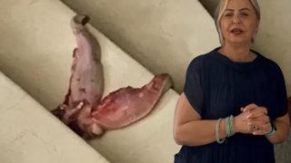 Doktora 'dana dili'yle tehdit olayında flaş gelişme! İfadesi ortaya çıktı: Limonata göndermemin sebebi...