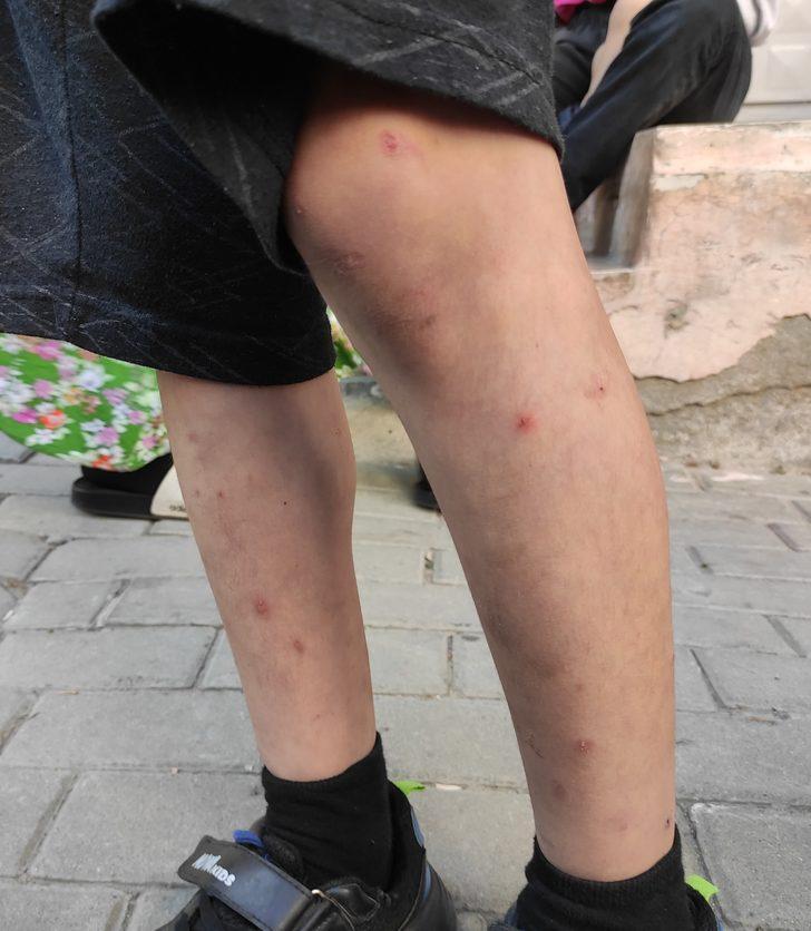 İstanbul'da sivrisineklerin görülme sıklığında artış yaşanıyor G1