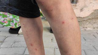 İstanbul'da sivrisineklerin görülme sıklığında artış yaşanıyor