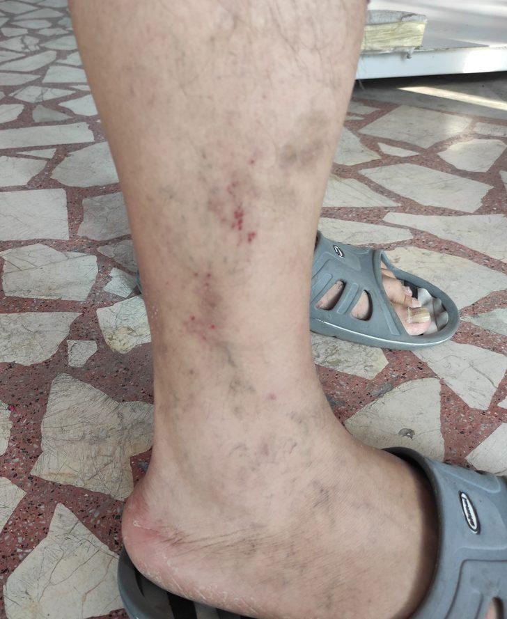 İstanbul'da sivrisineklerin görülme sıklığında artış yaşanıyor G2