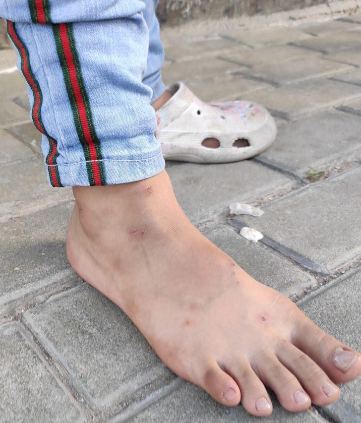 İstanbul'da sivrisineklerin görülme sıklığında artış yaşanıyor G3