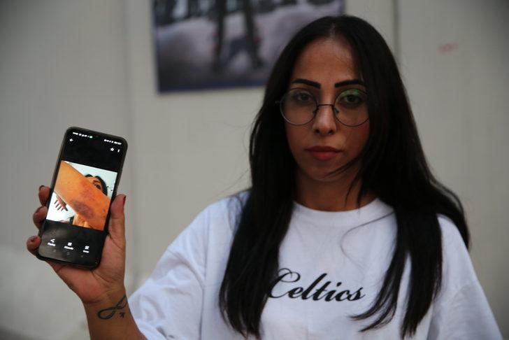 Eski eşinden darp ve tehdit iddiasıyla şikayetçi oldu G2