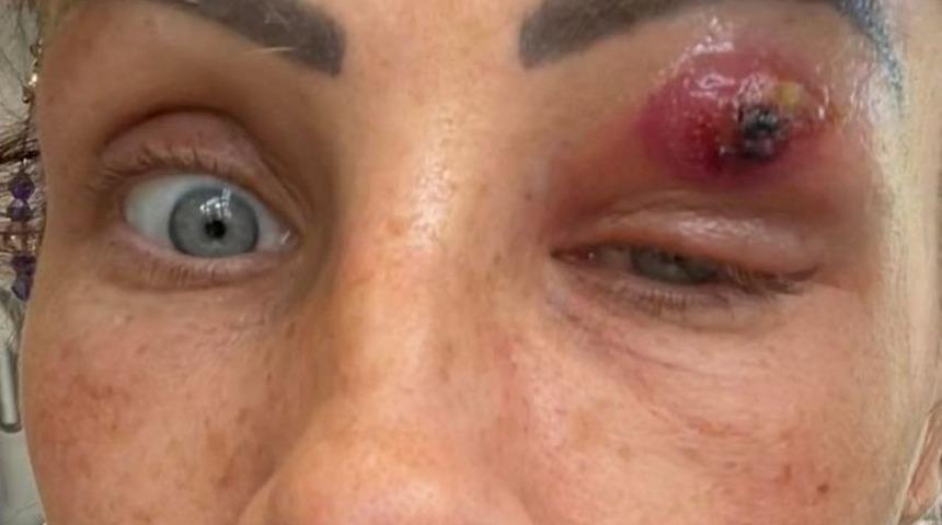 Sanki uzaylı filmi! Göz kapağının ardında gizlenen çok bacaklı yaratık...