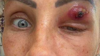 Sanki uzaylı filmi! Göz kapağının ardında gizlenen çok bacaklı yaratık...