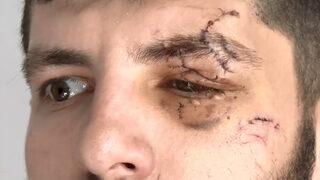 Ayrıldığı iş yerinden maaşının kalanını istedi! Cam bardak fırlatıldı, gözüne 32 dikiş atıldı