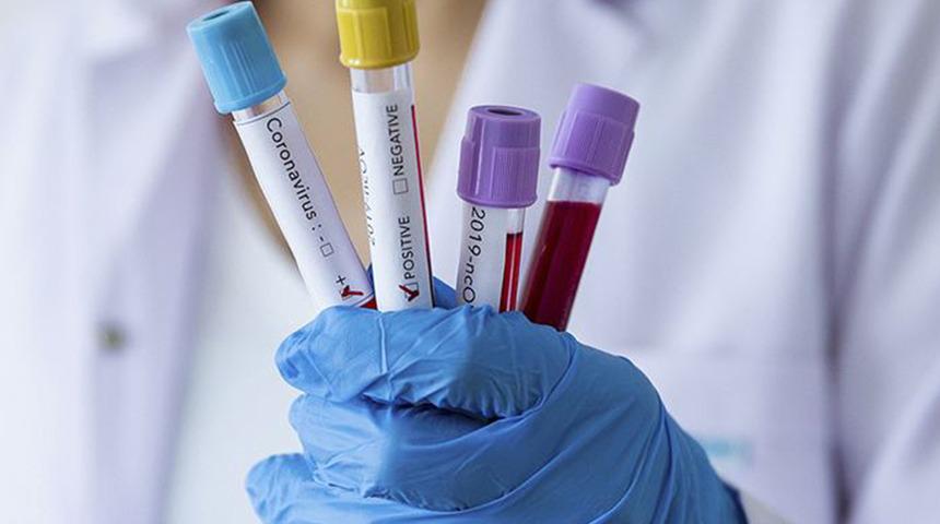 Rusya'dan gündeme bomba gibi düşen iddia! 'Koronavirüs insan yapımı ve ABD'nin parmağı var'