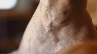 Varis oluşmaması için dikkat edilmesi gerekenler