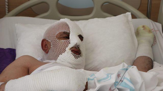 Tıkalı lavaboya kimyasal döktü, olanlar oldu: Kimse bilmediği işi yapmasın