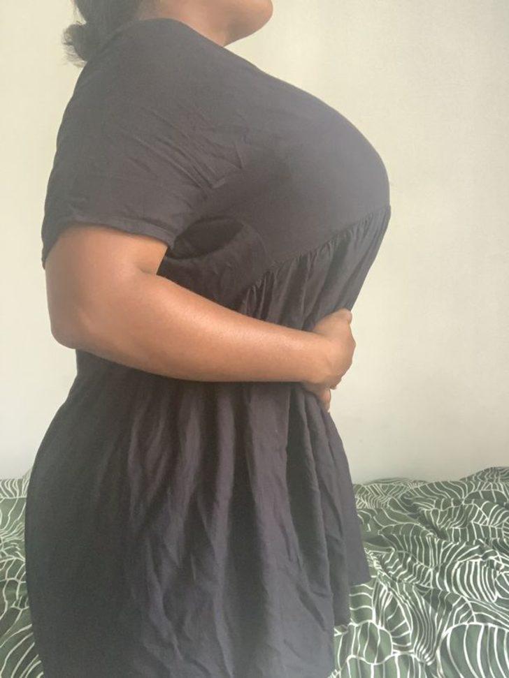 Sosyal medyadan yardım isteyince gündem oldu! “Göğüslerim o kadar büyük ki nefes alamıyorum” G2