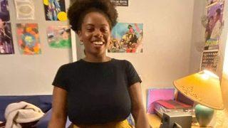 Sosyal medyadan yardım isteyince gündem oldu! “Göğüslerim o kadar büyük ki nefes alamıyorum”