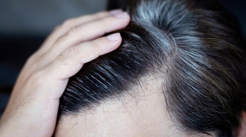 Hemen elinizdekini bırakın! Saçınız beklenmedik şekilde beyazlamaya başladıysa doktora koşun