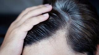 Hemen elinizdekini bırakın! Saçınız beklenmedik şekilde beyazlamaya başladıysa doktora koşun