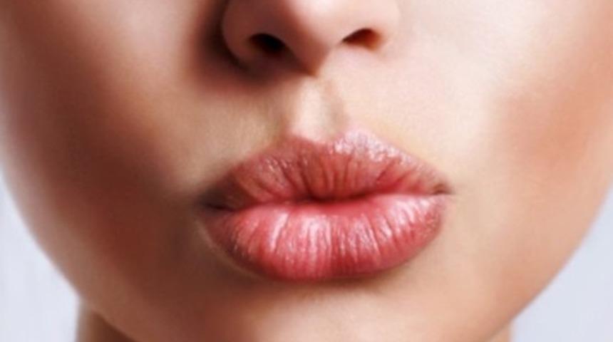 Dudak dolgusu yaptırmadan &ouml;nce bilmeniz gereken 18 şey