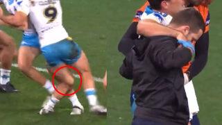 Korkunç sakatlık! Görenlerin yüreği hopluyor...