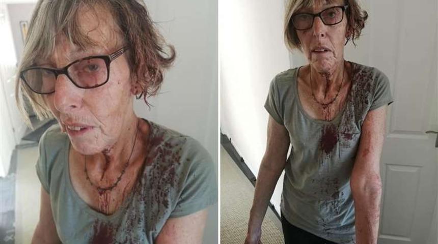 Yaşlı kadın kan içinde kaldı! Saldırganı görenler şaşkına döndü