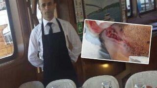 Pitbull, Saldır komutu verilince... Kulağını kaybetme ihtimali yüzde 90 İnternette tanışıp sevgili olmak istemişti