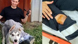 Hastanede pes dedirten olay! Kendisini tedavi eden acil tıp teknisyenini makasla yaraladı