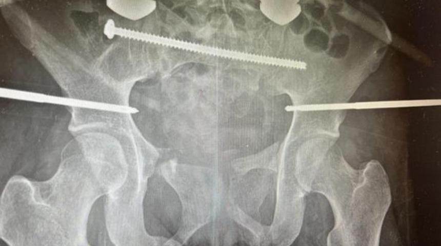 Doktorlar yaşama ihtimali %0 demişti! Son hali görenleri şaşırttı