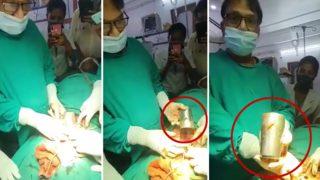 Hastanın midesinden çelik bardak çıktı! Doktorlar ameliyathanede şoke oldu