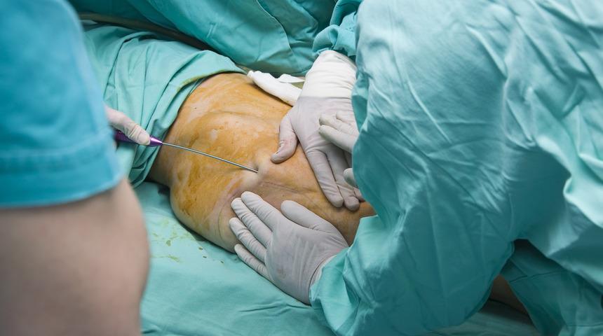 Ünlü şarkıcının karısı hayatını kaybetti! Estetik operasyonları ne kadar güvenli?